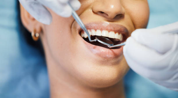 Best Knocked-Out Tooth Emergency  in Benbrook, TX