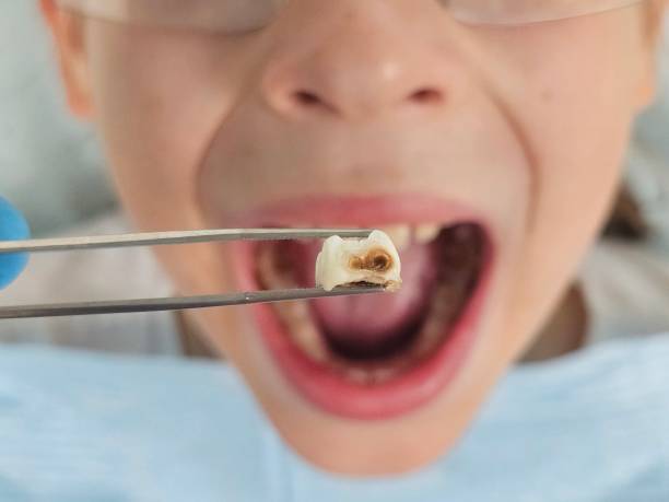 Best Dentist for Dental Trauma  in Benbrook, TX